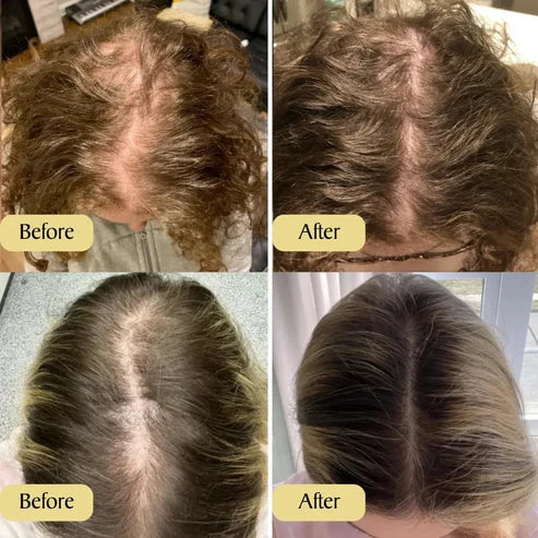 Thrive Hair Growth Oil